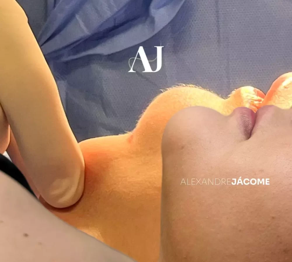 ALEXANDRE - FEED